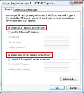 obtain an IP address automatically in Windows Vista